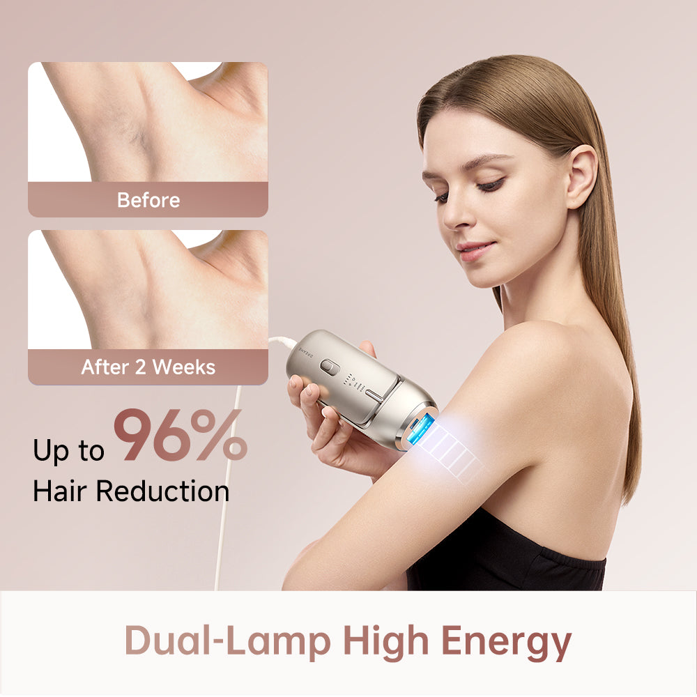 Dreame Nova IPL Hair Removal Device